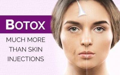 Botox: Much More Than Skin Injections