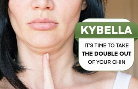 KYBELLA - It’s Time to Take the Double Out of Your Chin | Winston Salem ...