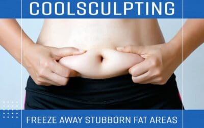 CoolSculpting: Freeze Away Stubborn Fat Areas