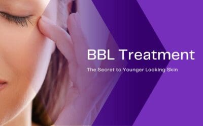 BBL Treatment – The Secret to Younger Looking Skin