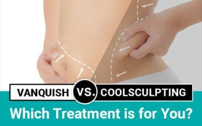 Vanquish vs. CoolSculpting: Which Treatment Is for You?