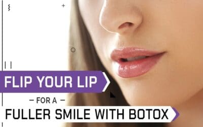 Flip Your Lip for a Fuller Smile with Botox