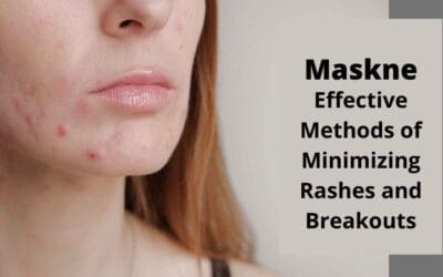 Maskne: Effective Methods of Minimizing Rashes and Breakouts