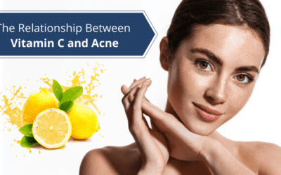 The Relationship Between Vitamin C and Acne