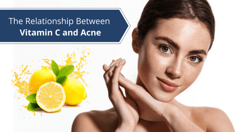 The Relationship Between Vitamin C and Acne  Acne Treatment