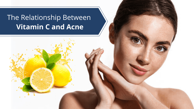 The Relationship Between Vitamin C And Acne Winston Salem Dermatology