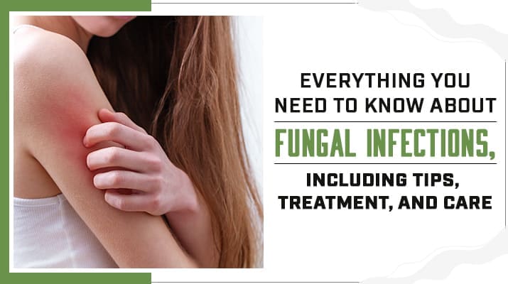 Everything You Need to Know About Fungal Infections, Including