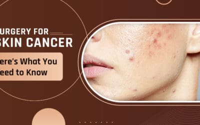 Surgery for Skin Cancer – Here’s What You Need to Know