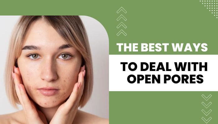 Open Pores