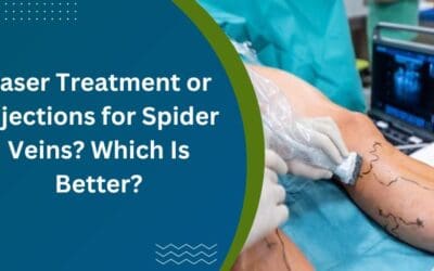 Laser Treatment or Injections for Spider Veins? Which Is Better?
