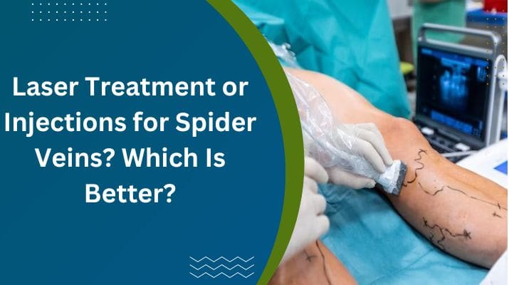 Laser Spider Vein Removal & Therapy Treatment Rochester MN - Slow Coast Spa
