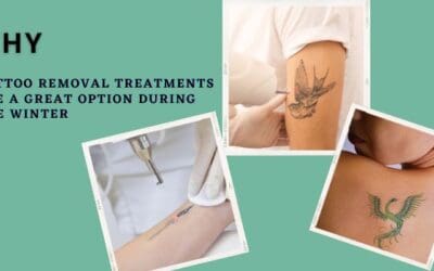 Why Tattoo Removal Treatments Are a Great Option During the Winter