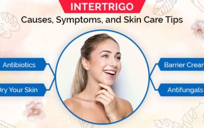 Intertrigo: Causes, Symptoms, and Skin Care Tips