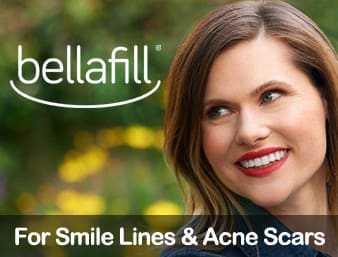 Bellafill®